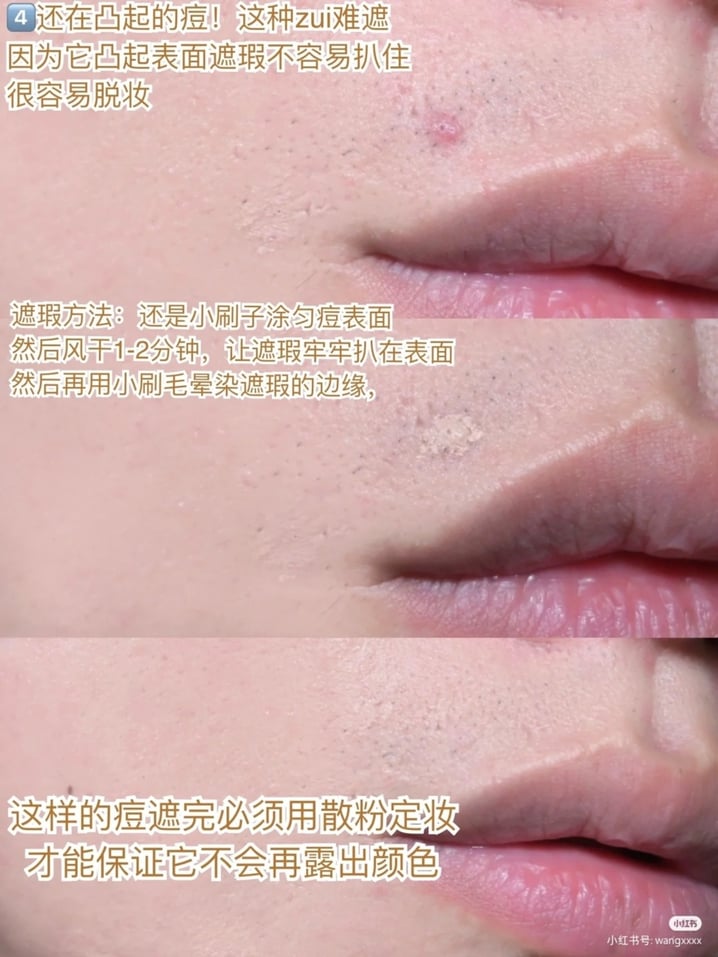 4、还在凸起的痘