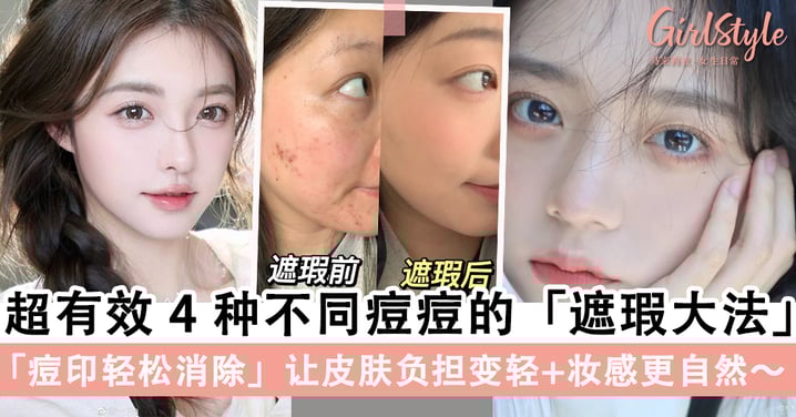 痘痘肌女孩救星!4种不同痘痘的「遮瑕大法」,「暗疮痘印轻松消除」让皮肤负担变轻+妆感更自然~