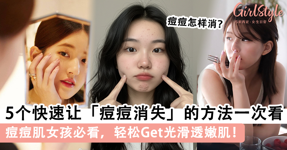 痘痘怎样消?5个快速让「痘痘消失」的方法一次看
