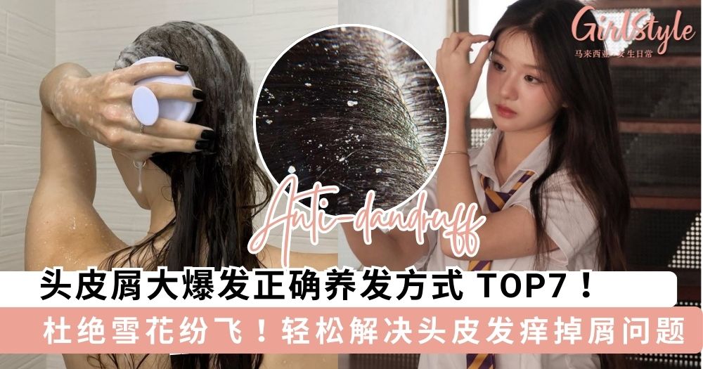 拒绝“雪花”纷飞！头皮屑多只要做好这7点，发根清爽一整天！ ❄️✨