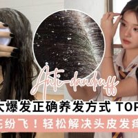 拒绝“雪花”纷飞！头皮屑多只要做好这7点，发根清爽一整天！ ❄️✨