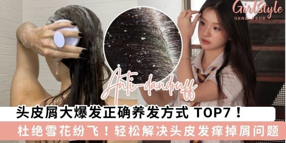 拒绝“雪花”纷飞！头皮屑多只要做好这7点，发根清爽一整天！ ❄️✨